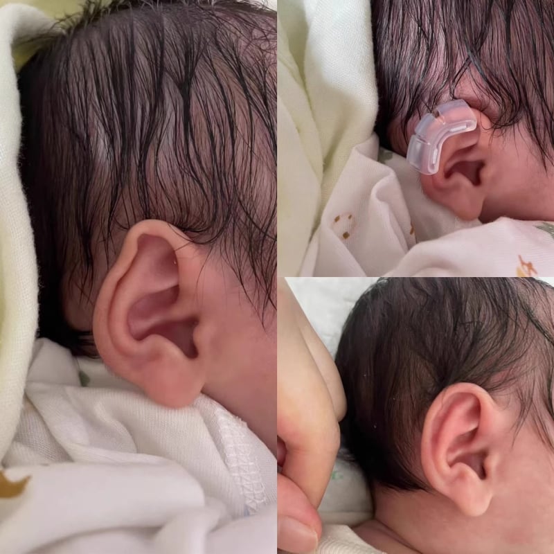 Ушно коригиращо устройство за новородени и възрастни, лепенки за ушна хрущял и поддръжка зад ухото за изпъкнали уши — Color industry; Модел: See description; Време на пазара: See description; Сертификация: Няма