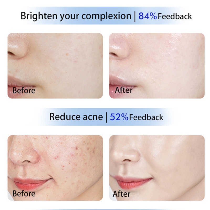 Μάσκα ομορφιάς με φωτοθεραπεία – φως πολυφάσματος για ανάπλαση και λάμψη δέρματος, τροφοδοσία μέσω πρίζας, μοντέλο Lyzm2026, έκδοση 2024