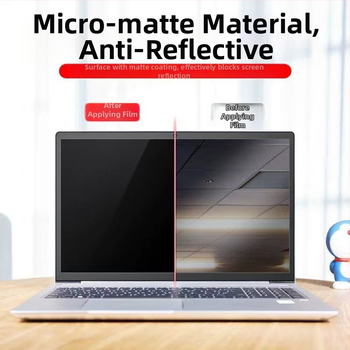 Protecție pentru ecran pentru Apple MacBook Air M4/M5 – Snap-on, Anti-Blue Light, Anti-Peep, Acoperire PET/PVC