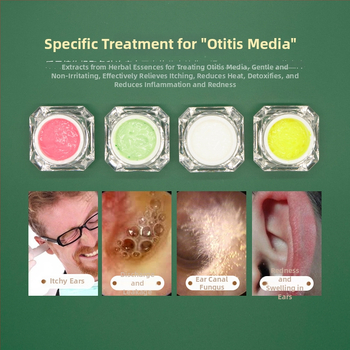 Sada starostlivosti o uši: nežiariaca lyžička na uši a krém na starostlivosť, úľava od začervenania a svrbenia, 10–20 g