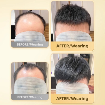 Férfi rövid hajú paróka, valódi emberi hajból, teljesen kézzel szőtt, felső koronai rész, festhető és göndöríthető.