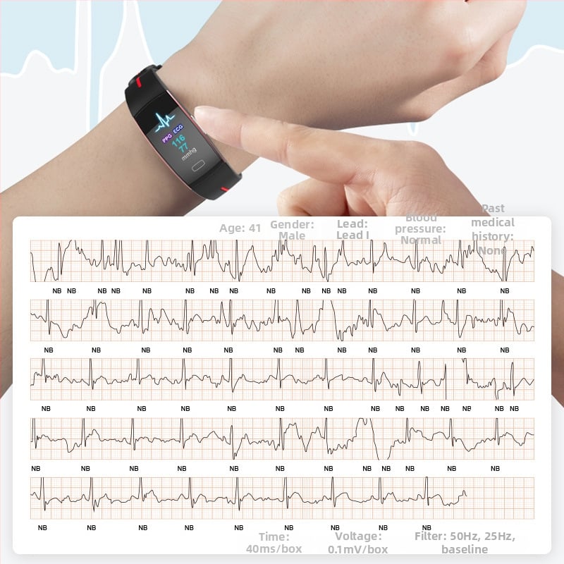 P3 Náramok s farebným displejom P3Plus — meranie krvného tlaku v reálnom čase, srdcová frekvencia, ECG+PPG, telesná teplota, starostlivosť o blízkych