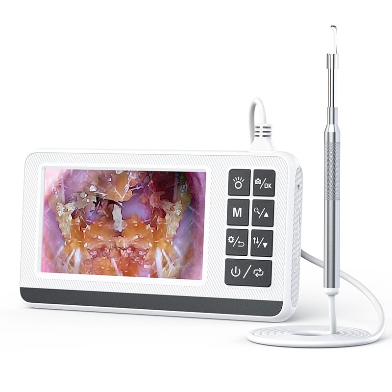 Otoscop cu lumină, lingură pentru urechi, diametru 3,9 mm, 4,3 inch, alimentare USB