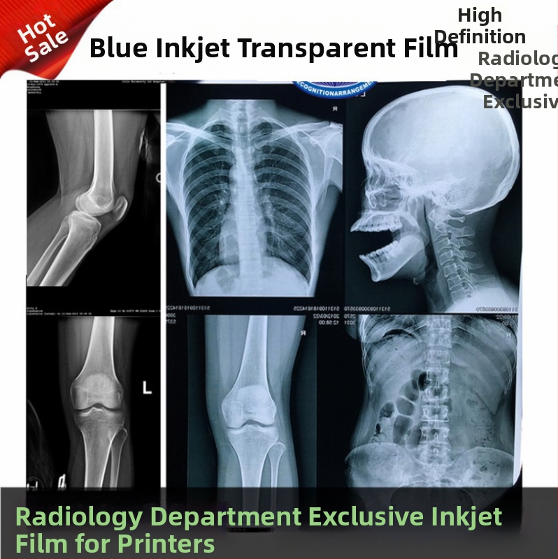 Zubný röntgenový film pre suchú radiológiu tlač DR/CR/CT, modré pozadie