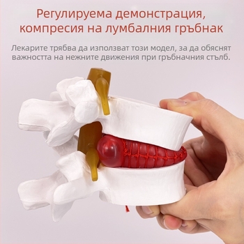 Лумбален модел за медицинско обучение – демонстрация на компресия на лумбалния диск и патология на костите на гръбначния стълб.