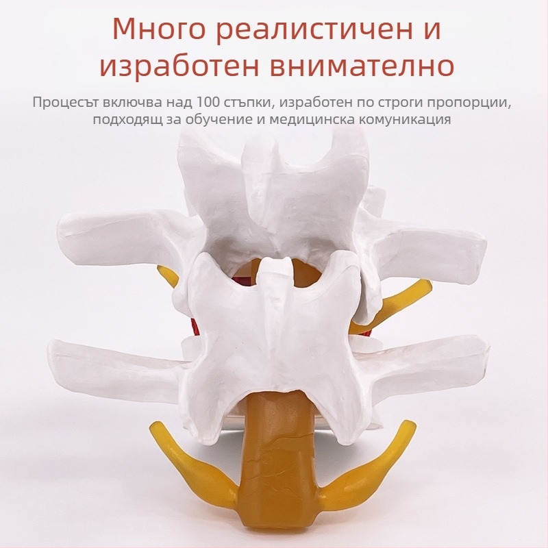Лумбален модел за медицинско обучение – демонстрация на компресия на лумбалния диск и патология на костите на гръбначния стълб.