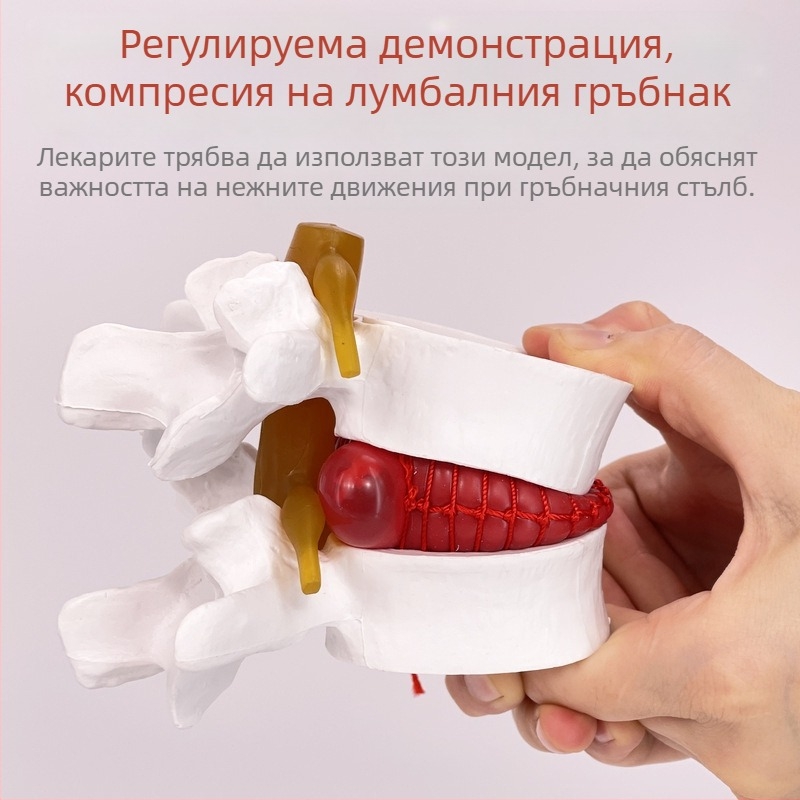 Лумбален модел за медицинско обучение – демонстрация на компресия на лумбалния диск и патология на костите на гръбначния стълб.