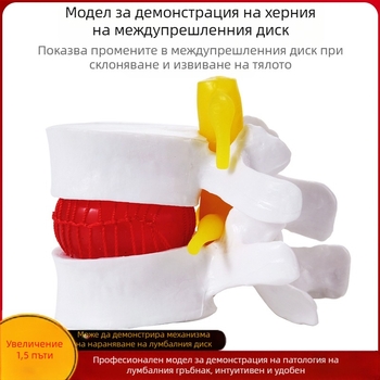Модел на междупрешленния диск, PVC учебен анатомичен модел за демонстрация на патология на лумбалния гръбнак, Zhenghe River