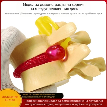 Модел на междупрешленния диск, PVC учебен анатомичен модел за демонстрация на патология на лумбалния гръбнак, Zhenghe River