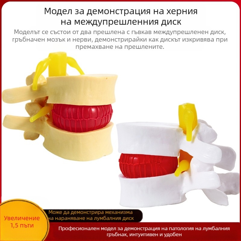 Модел на междупрешленния диск, PVC учебен анатомичен модел за демонстрация на патология на лумбалния гръбнак, Zhenghe River