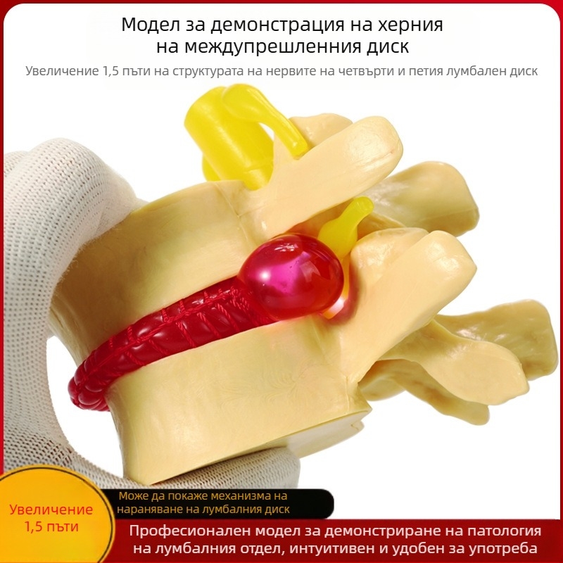 Модел на междупрешленния диск, PVC учебен анатомичен модел за демонстрация на патология на лумбалния гръбнак, Zhenghe River