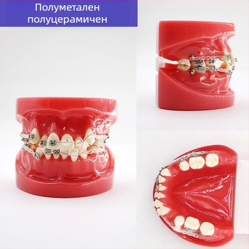 Учебен стоматологичен модел за дентална патология и възстановяване със стандартен имплантен модел, местен бранд, с печатано лого, подходящ за стоматологично обучение