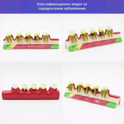 Учебен стоматологичен модел за дентална патология и възстановяване със стандартен имплантен модел, местен бранд, с печатано лого, подходящ за стоматологично обучение