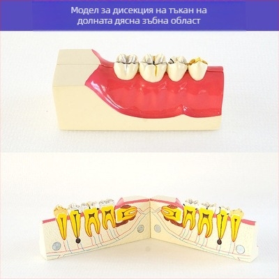 Учебен стоматологичен модел за дентална патология и възстановяване със стандартен имплантен модел, местен бранд, с печатано лого, подходящ за стоматологично обучение