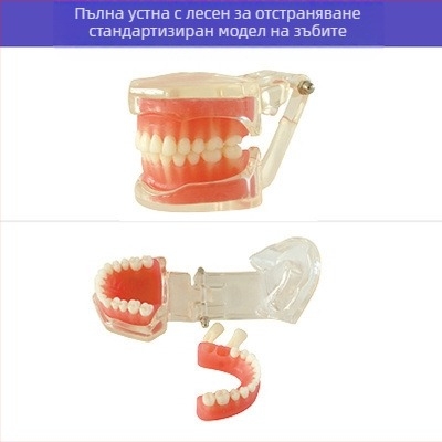 Учебен стоматологичен модел за дентална патология и възстановяване със стандартен имплантен модел, местен бранд, с печатано лого, подходящ за стоматологично обучение