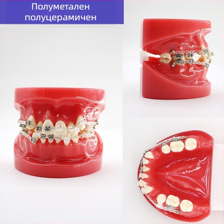 Учебен стоматологичен модел за дентална патология и възстановяване със стандартен имплантен модел, местен бранд, с печатано лого, подходящ за стоматологично обучение