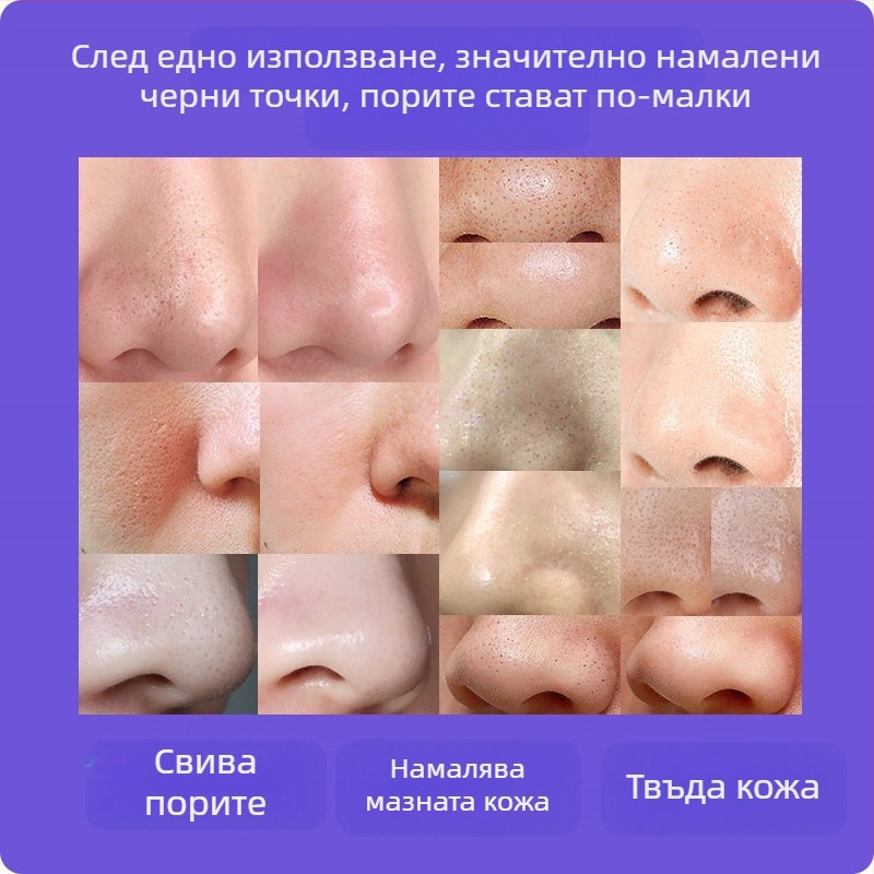 Визуално премахване на черни точки — ултразвуков ръчен уред, модел ZM613, ABS корпус, 3 степени на настройка