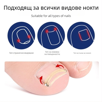 Пръстен за крак за нокти с разтягащ се механизъм и ролка за канала на нокътя; миещ се, повторно използваем, 18 g гума и неръждаема стомана