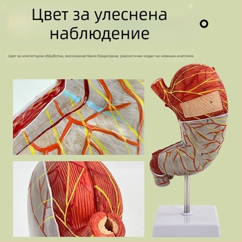 Модел на човешки стомах за анатомия — коронален разрез, патологичен модел със перфорация, обучение по гастроентерология