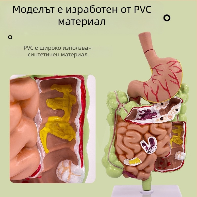 Модел на човешки стомах за анатомия — коронален разрез, патологичен модел със перфорация, обучение по гастроентерология