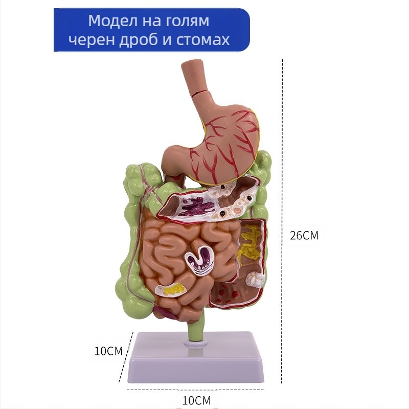 Модел на човешки стомах за анатомия — коронален разрез, патологичен модел със перфорация, обучение по гастроентерология