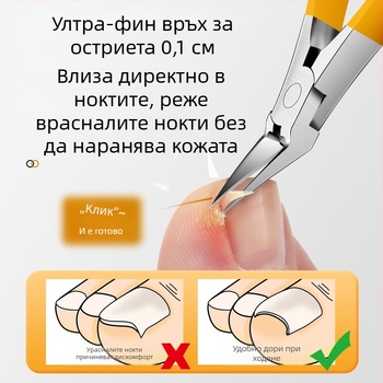 Ingrown nail clipper Mingxiang – пластмаса + неръждаема стомана, преносим за домашна употреба, клипър за врастнал нокът, улей за нокти, многофункционални пинсети