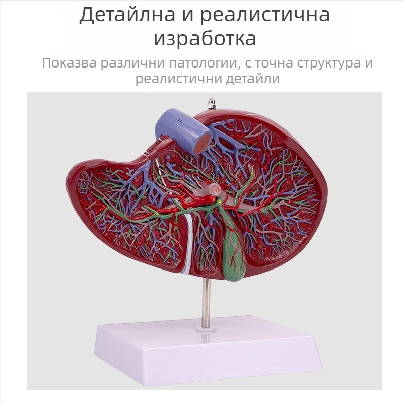 Изключително реалистичен анатомичен модел на черен дроб с хепатобилиарно–панкреасно–селезенка–дуоденална система и релефни лезии