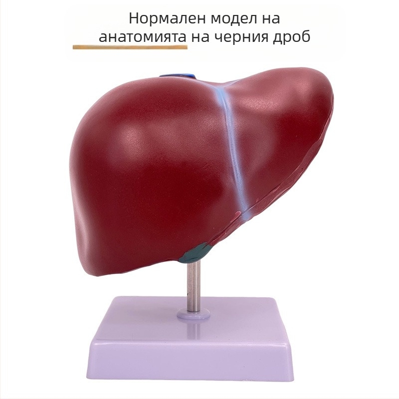 Изключително реалистичен анатомичен модел на черен дроб с хепатобилиарно–панкреасно–селезенка–дуоденална система и релефни лезии