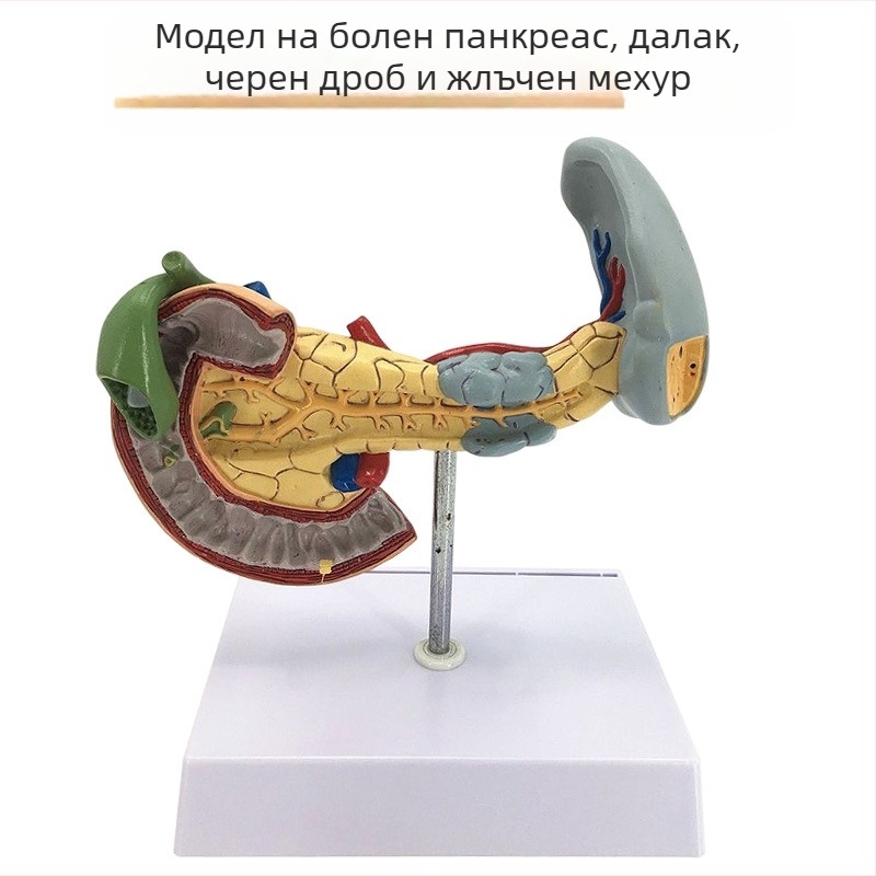 Изключително реалистичен анатомичен модел на черен дроб с хепатобилиарно–панкреасно–селезенка–дуоденална система и релефни лезии