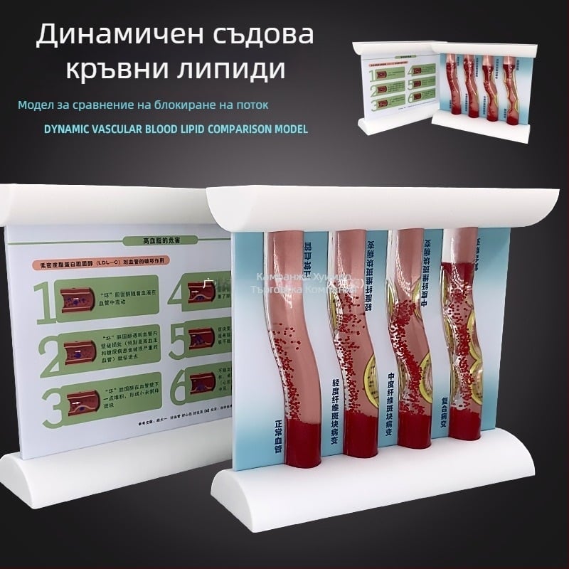 Динамичен модел на кръвоносен съд от пластмаса за демонстрация на висока плътност на запушване и плаков тромб – учебен модел