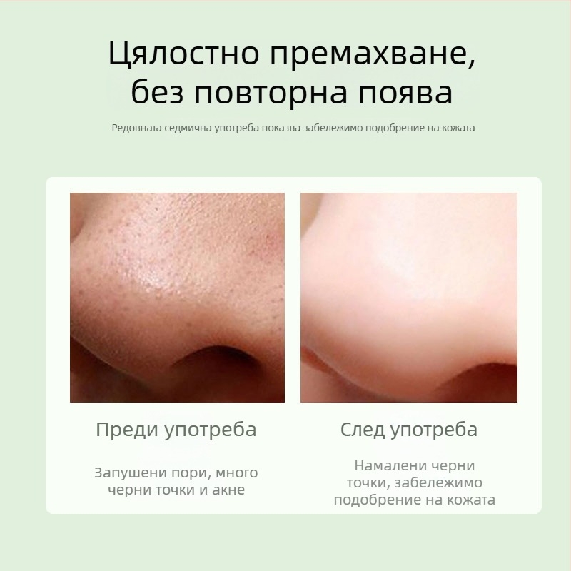 Устройство за визуално почистване на лице за премахване на черни точки, с HD дисплей и вакуумно всмукване за дълбоко почистване на порите
