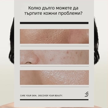 Chise кислородна маска с малки балончета – почистваща, хидратираща гел-маска за лице, контрол на омазняването