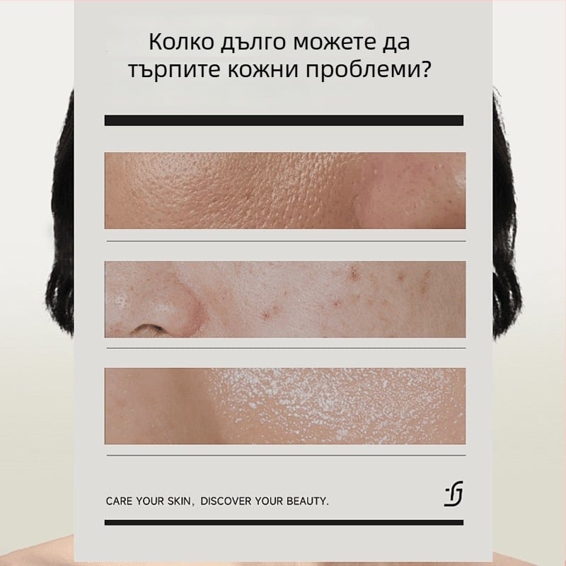 Chise кислородна маска с малки балончета – почистваща, хидратираща гел-маска за лице, контрол на омазняването