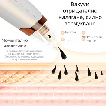 Устройство за премахване на черни точки с вакуум, електрическо домашно средство за красота, модел 5678, 3-та степен на регулиране