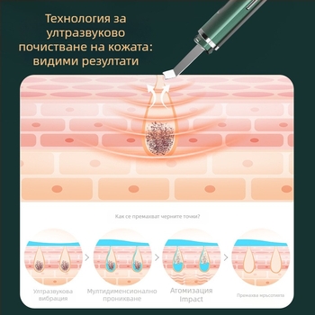 Ултразвуков пилинг инструмент за премахване на черни точки и йонно въвеждане, модел C62, EMS микро-ток функция, 3 нива на настройка, ABS корпус