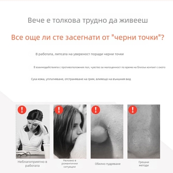 Устройство за премахване на черни точки с електрически режим на въртене, модел SL0001, функция: всмукване на черни точки, 3 скорости, CE/FCC/ROHS сертификати