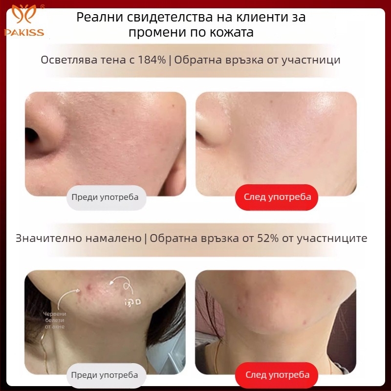 Устройство за подмладяване на кожата с LED фототерапия, преносимо, IPX5 водоустойчиво, за домашна употреба, без вградена батерия