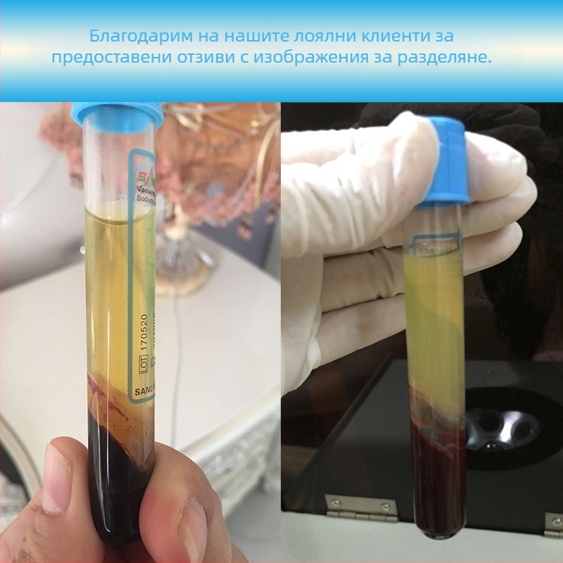 Еднократна PRP кръвна тръба със стерилен гел сепаратор на натриев цитрат за разделяне на серума