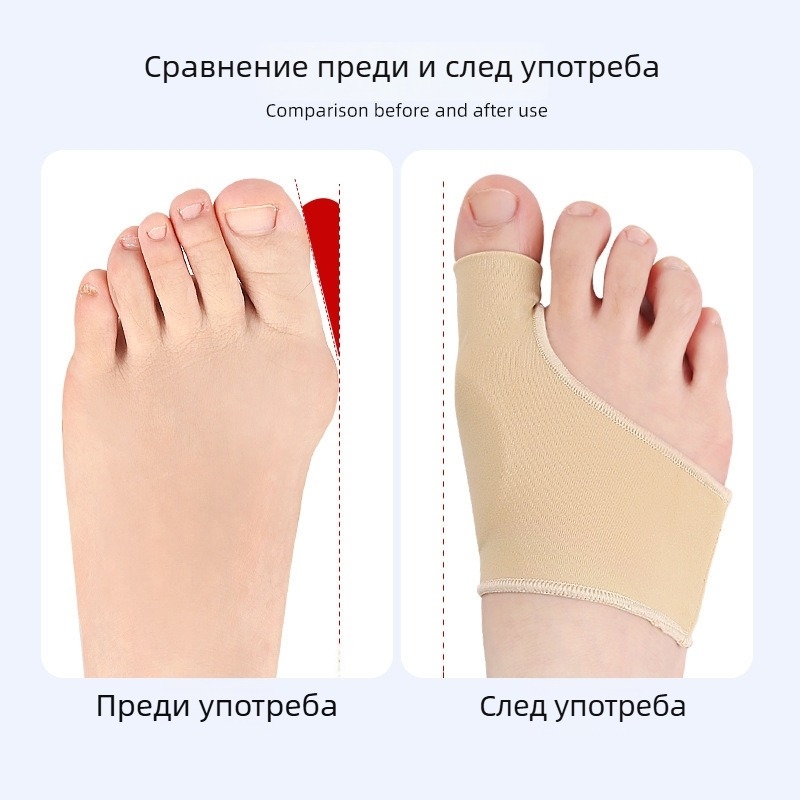 Feet Wake Up Lycra SEBS протектор за hallux valgus, защита за големия пръст и костите на стъпалото, еверзионен протектор за крак, целогодишна употреба