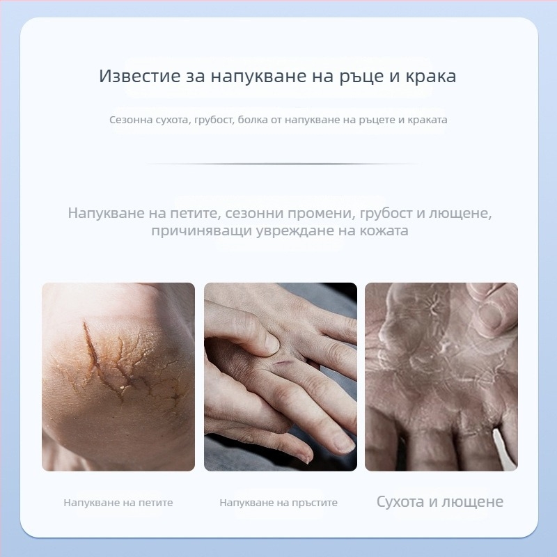 Дишащ патч за напукана кожа на ръцете и краката, платнен Band-aid с антихлъзгаща функция, 2-годишен срок на годност, универсално приложение, индивидуално опаковано