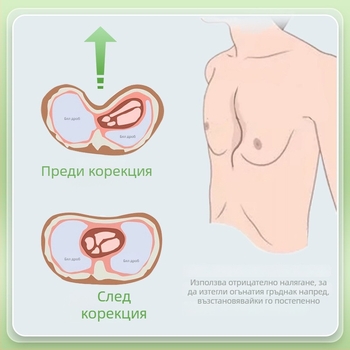 Коректор за фуниеобразен гръден кош с вакуумна чашка — силиконово тяло, модел YKS-4031, марка Medium