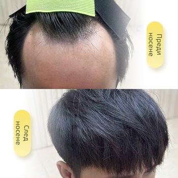 Пришивка за коса с М-образна линия за мъже и жени, ръчно тъкана, човешки коси, прави коси, подходяща за боядисване