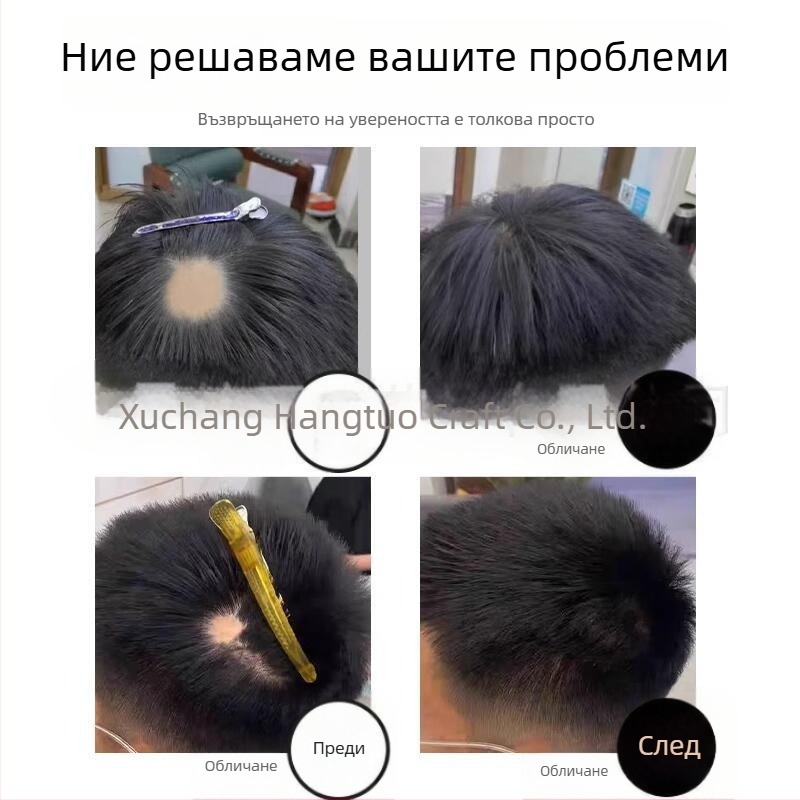 Биологичен пластир за скалп при белези и алопеция – човешки косъм, ръчно тъкана, може да се боядисва