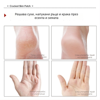 Лепенки за напукана кожа на ръцете и краката, дишащи, индивидуално опаковани