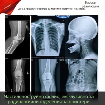 Дентален рентгенов филм за сухо радиологично принтиране, синя основа, Inkjet DR/CR/CT