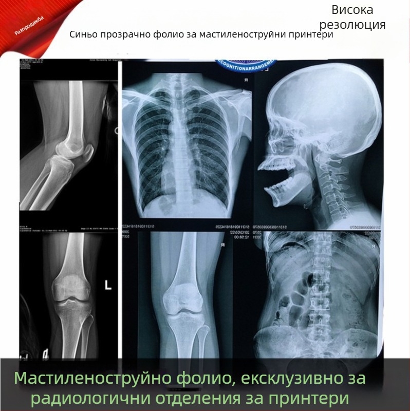 Дентален рентгенов филм за сухо радиологично принтиране, синя основа, Inkjet DR/CR/CT
