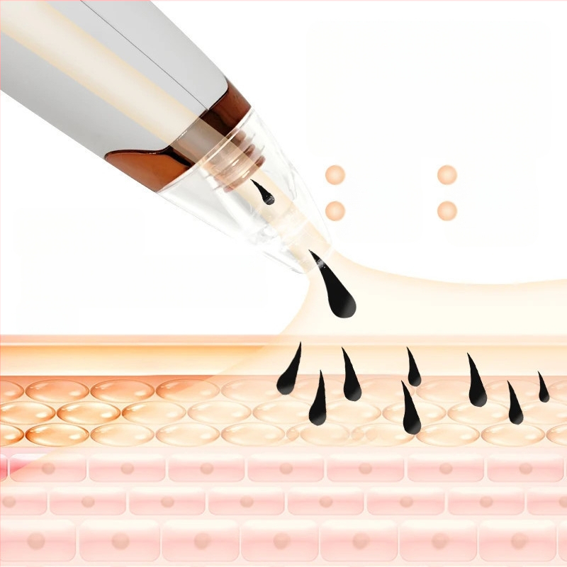 Juodųjų inkštirų siurbimo įrenginys, elektrinis namų kosmetikos įrankis, modelis 5678, 3 pakopų reguliavimas