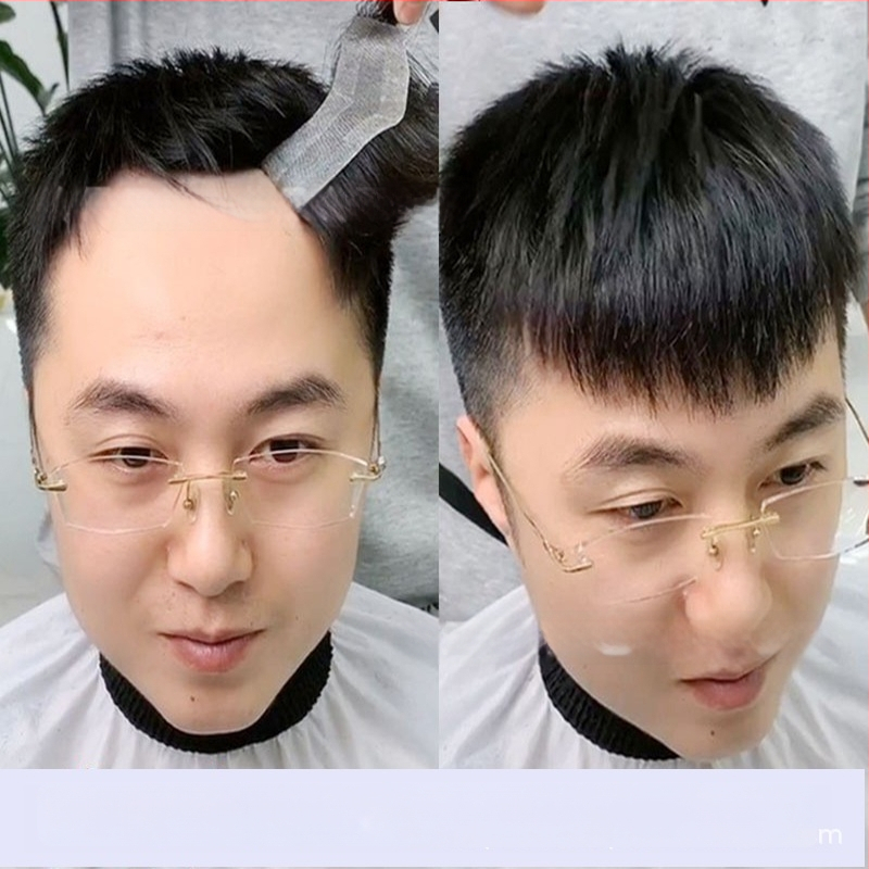 Férfi homlokvonal-paróka – teljesen kézi szövésű, valódi emberi hajból, festhető vagy göndöríthető, minden bőrszínhez illeszkedik.