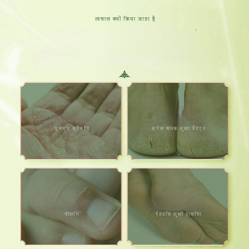 Avokado aliejaus kremas įtrūkimų odai - Dr.Martinson, tekstūra pasta, vaisinis kvapas, galiojimo laikas 2 metai, kūno priežiūros rinkinys