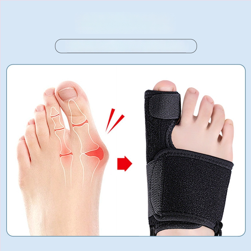 Ortez Hallux Valgus s podesivim fiksacijskim remenom za prste, dan i noć